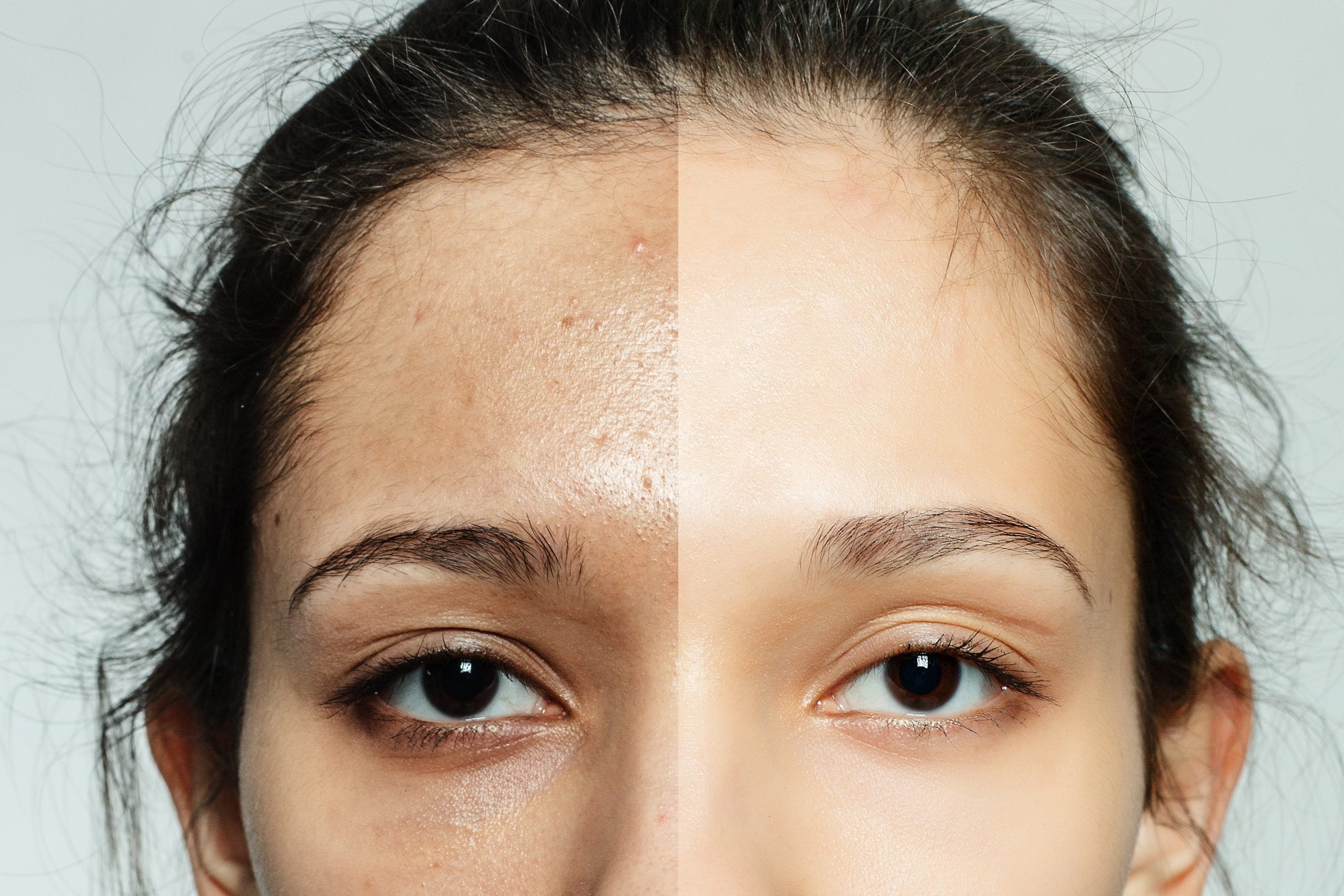 health, people, youth and beauty concept - Before and after cosmetic operation. Young pretty woman portrait. Before and after cosmetic or plastic procedure anti-age therapy, treatment
