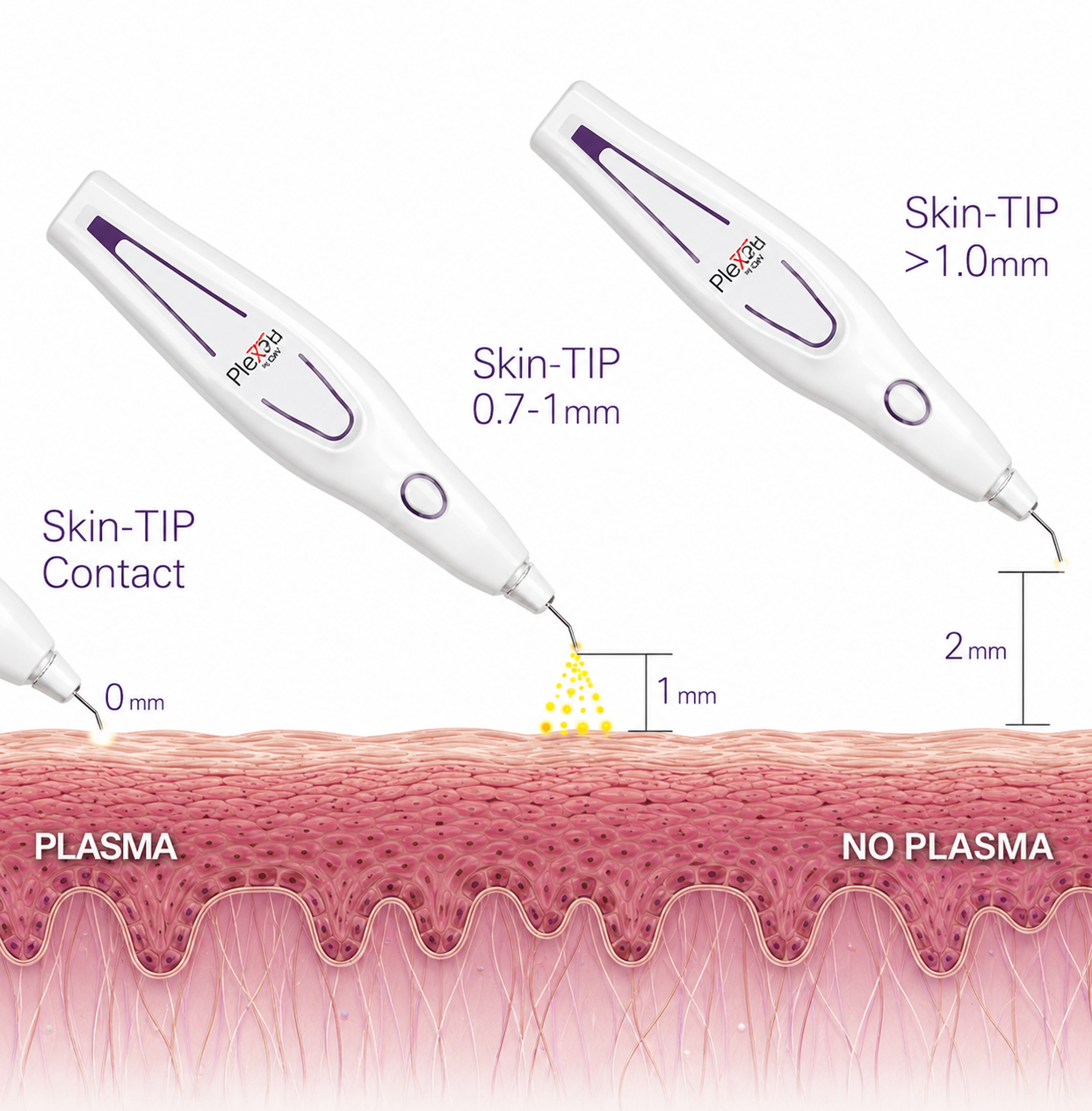 PLEXR Plus plasma therapy illustration showing proper tip-to-skin distance for controlled plasma energy treatment.